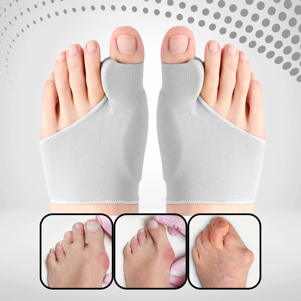 Bunion Corrector - Toe Separator and Corrector