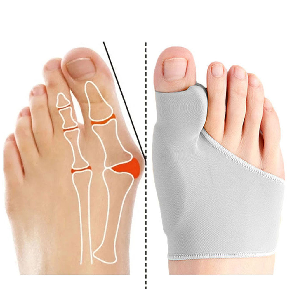Bunion Corrector - Toe Separator and Corrector